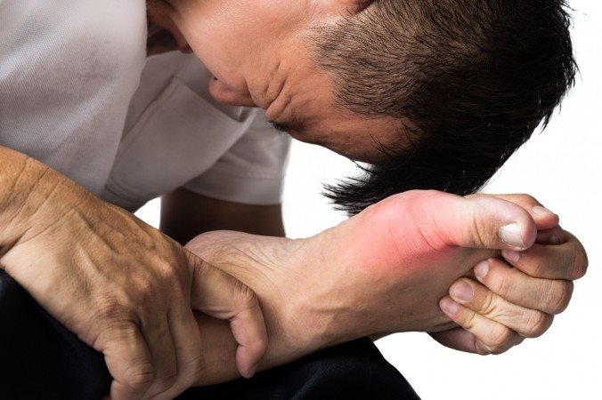 Cơn đau Gout cấp - Cực khó chịu và đau thấu xương